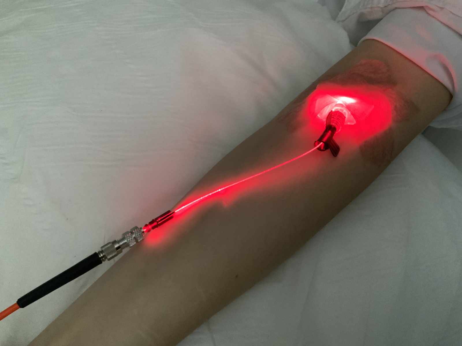 IV Laser Red